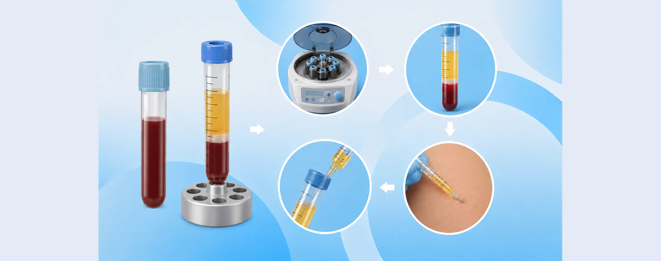 P-Shot PRP preparation process — Russald Medical Center, Tijuana
