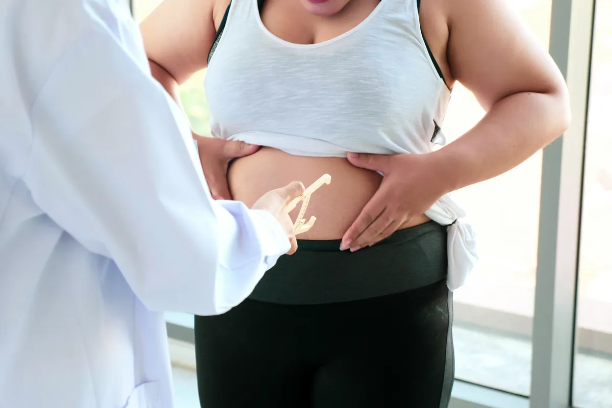 Bariatric Revision procedure at Russald Medical Center, Tijuana