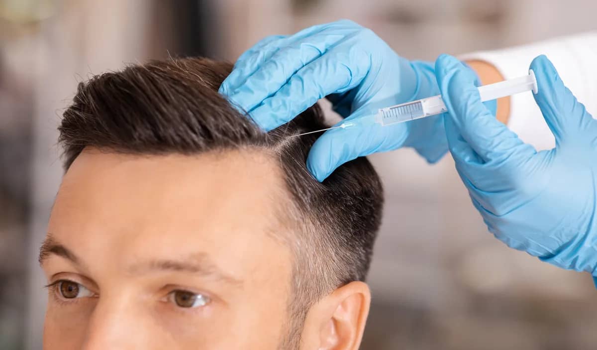 Hair PRP procedure at Russald Medical Center, Tijuana