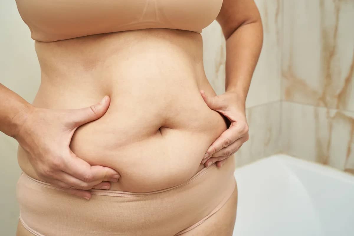 Tummy Tuck procedure at Russald Medical Center, Tijuana