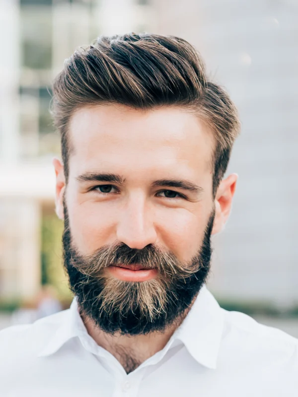FUE Hair Transplant
