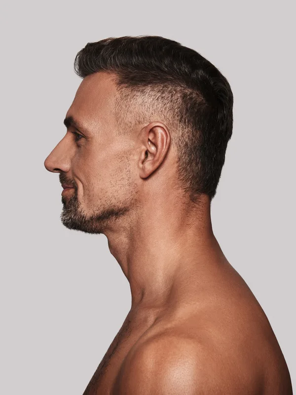 Hombre de perfil que muestra la definición del tercio inferior del rostro y la línea mandibular